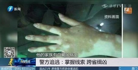 追兇21年,！僅憑一張照片和一個體征　福建警方抓住逃犯